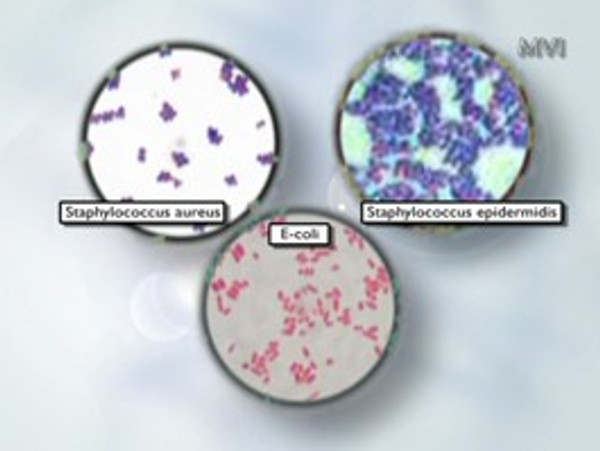 Gram Staining, Laboratory Training, Run Time: 17 Minutes, MV-LAB-0747